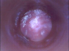 #cervix #endoscope #womb gif