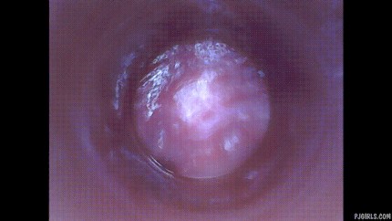 Cervix 和Endoscope 色情片动图 Pornhub com 