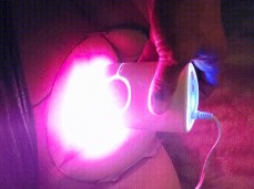 laser hair removal gif