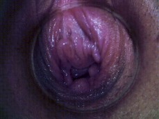Vaginal Rugae ( Pussy Close Up ) 2 gif