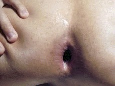 Twink Gaping Hole gif
