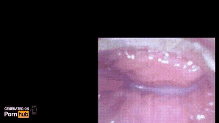 二次元 無修正 射精 gif 体内射精后 Porn Gif | Pornhub.com
