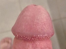 Edgind pearly crowned dick head gif