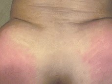 bouncing red cheeks gif
