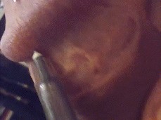 Needle Kink - Does It Excite You Too? or a Libido Killer? gif