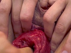 prolapse fuck with a finger gif