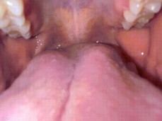 Oral Internal Mouth gif
