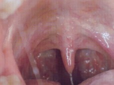 Oral Mouth gif
