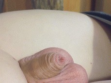 My Little Uncut Dick Starting To Grow gif