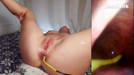 anal creampie