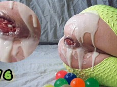 Extreme anal prolapse using 6 stress balls whit cum lube overload gif